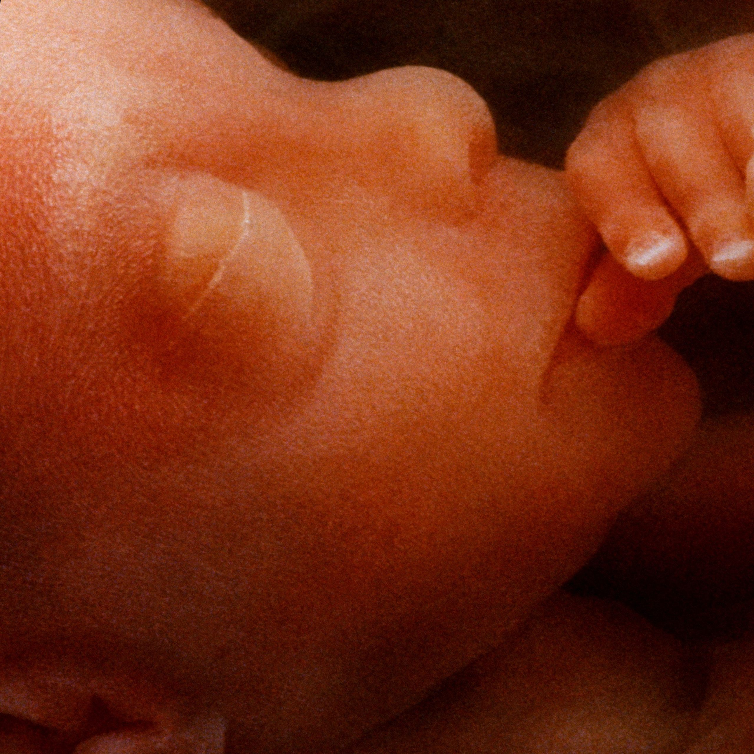 Critical Action Needed to Defend the Unborn of Virginia